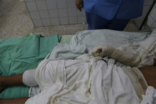 Tratamiento de quemados puede costar hasta un millón