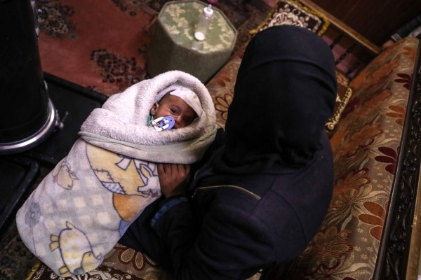 Bebé sirio tuerto tras un ataque se convierte en símbolo de solidaridad en redes