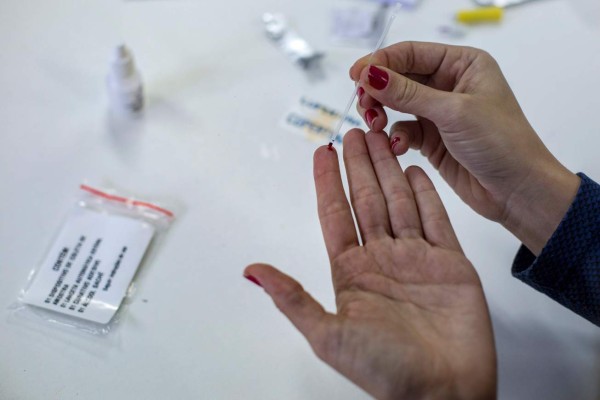 A woman shows how an HIV self-test kit works in Rio de Janeiro, Brazil on July 07, 2017. Brazil started selling, for the first time, HIV detection tests in pharmacies nationwide. / AFP PHOTO / Mauro PIMENTEL / TO GO WITH AFP STORY