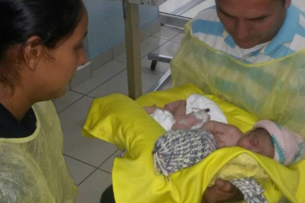 Comienzan gestiones para trasladar siamesas hondureñas al extranjero