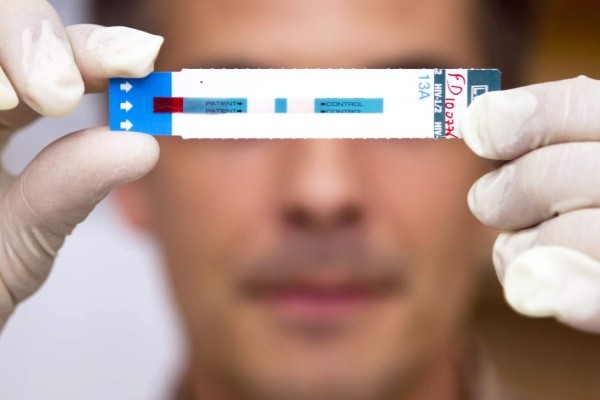 Un test de diagnóstico del VIH gana el premio Inventor Europeo