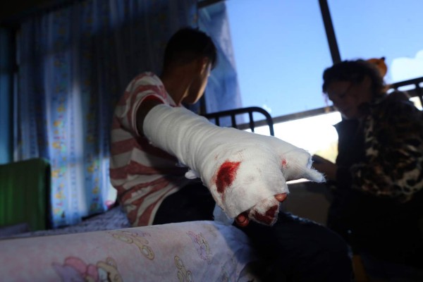 Celebración de fin de año deja a 19 quemados en Honduras