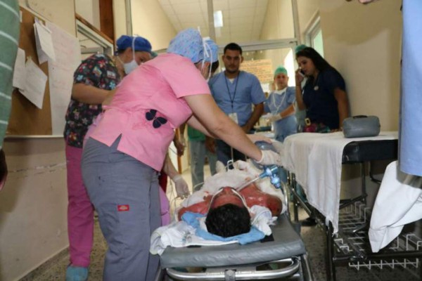 Muere padre de tres niños quemados en cohetería