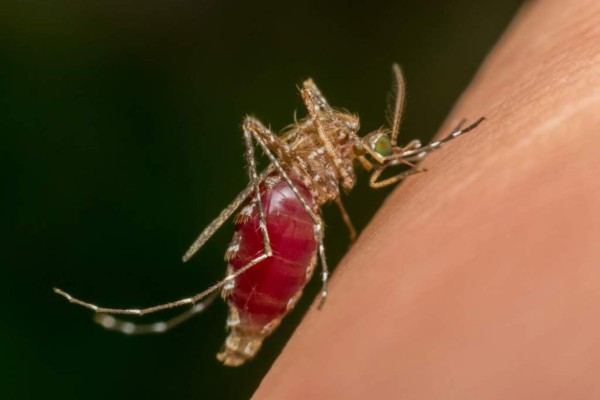 UCI: Niño con dengue lucha por su vida