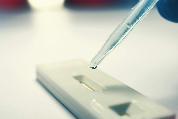 Una prueba barata podría detectar por dónde merodean los mosquitos del Zika