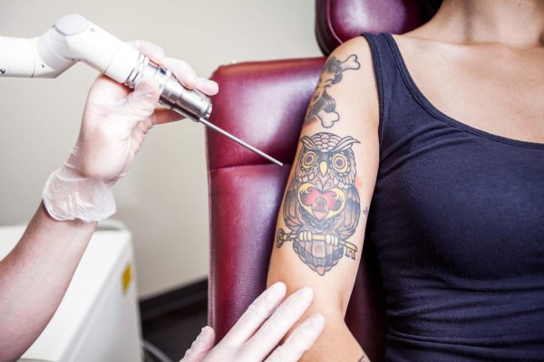 La FDA advierte de los peligros de los tatuajes