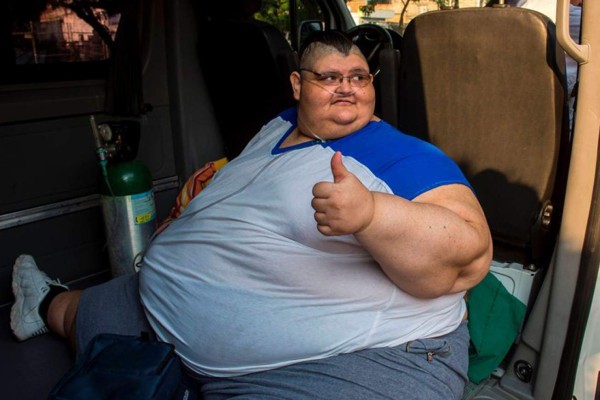 El hombre más obeso del mundo sale 'bien' de operación