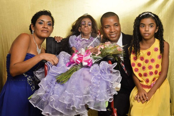 La quinceañera que envejeció antes de tiempo