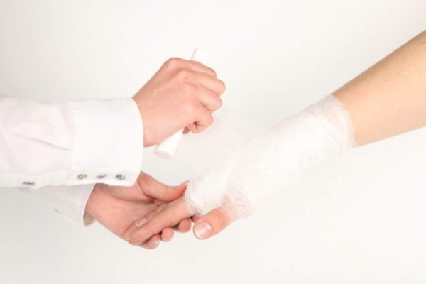 Las mordeduras en la mano ameritan atención médica