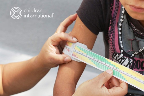 Falta de proteínas y calorías puede desnutrirlos