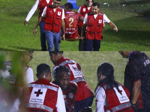 El jugador Kevin Álvarez no pudo seguir en el partido contra el Estrella Roja. Foto Neptalí Romero.