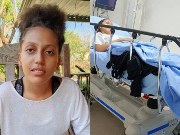 Ana Marcela Trochez Reyes, joven hondureña que recibe tratamiento en El Salvador.