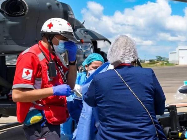 Un niño y una niña permanecen en Fundaniquem tras sufrir graves quemaduras en una explosión registrada en una vivienda de Copán.