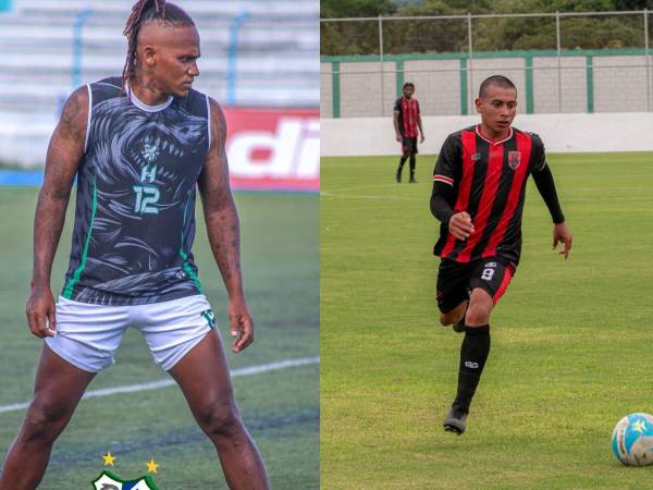 El conjunto escualo atraviesa un complicado inicio de campeonato. Después de cuatro jornadas, <b>Platense </b>apenas suma un punto.