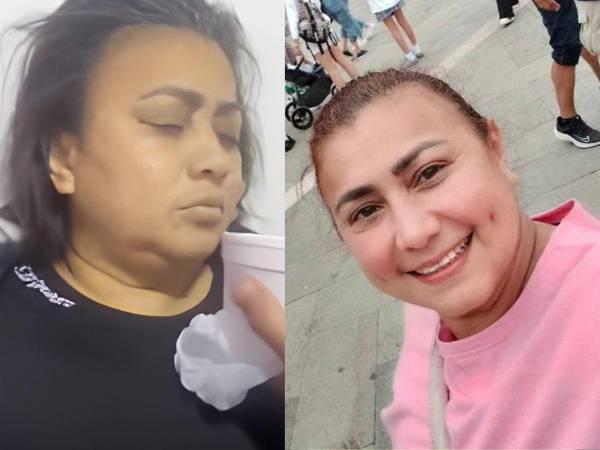 La desaparición de Yulixa Toloza, una mujer de 52 años, ha generado conmoción en Bogotá y reavivado las alertas sobre los riesgos de someterse a procedimientos estéticos clandestinos en Colombia.