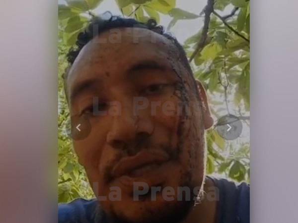 Exclusivo video: Esteban Ferrera, 'El Diablo', aparece herido