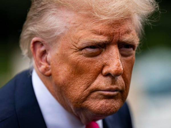 Trump fue diagnosticado con insuficiencia venosa tras presentar moretones e inflamación en las piernas.