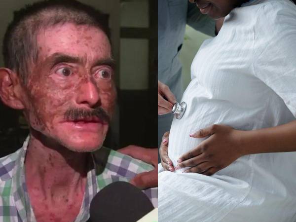Una escena estremecedora sacudió a una comunidad en el puerto de San José, Escuintla, Guatemala, donde un hombre fue arrestado tras presuntamente abrir el vientre de su propia hija embarazada para extraer al bebé que llevaba en gestación.