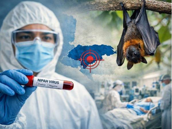 La tasa de mortalidad del virus Nipah oscila entre 40% y 75%, de acuerdo a la Organización Mundial de la Salud (OMS).