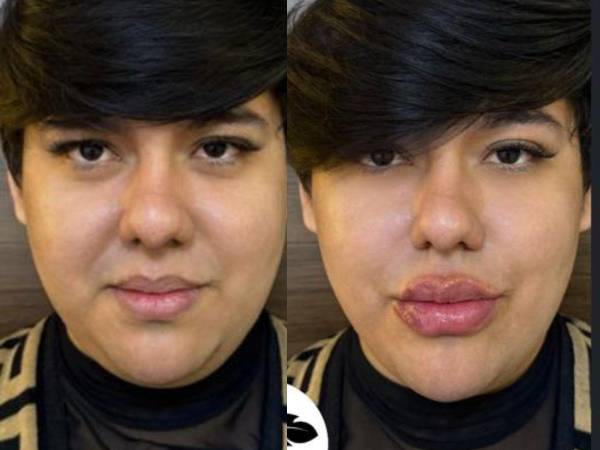 El polémico crítico de moda hondureño y creador de contenido Antonio Sandrez volvió a acaparar la atención en redes sociales, esta vez al presumir sus más recientes retoques estéticos.