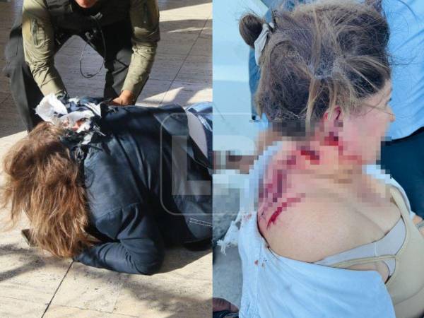 Video: María Antonieta Mejía muestra heridas de Gladis Aurora López