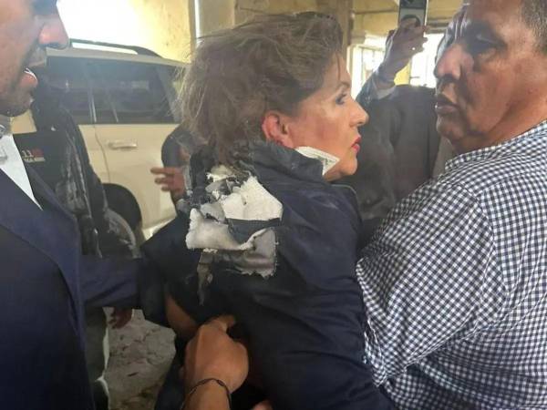 “No hay rencor”, dijo la diputada Gladis Aurora quien fue atacada con un artefacto explosivo.