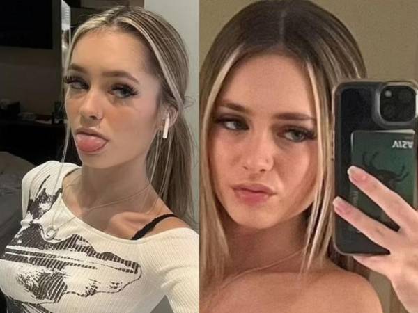 Sian Anderson se encuentra gravemente hospitalizada por una bacteria mortal causada por consumir cigarros electrónicos en Norwich, Norfolk.