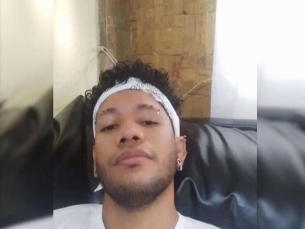 El joven estudiante, de 30 años, sufrió una herida de bala mientras participaba en una manifestación cerca de la Redoma de San Jacinto, en Maracay, estado de Aragua.