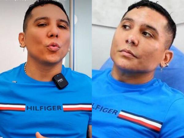 El vocalista de la Trakalosa de Monterrey ha recibido múltiples críticas por su nuevo rostro.