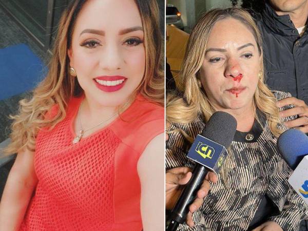 La noche del lunes, durante la entrega de planillas de movimientos internos de los partidos políticos ante el Consejo Nacional Electoral, la aspirante a diputada Sara Elizabeth Estrada Zavala fue agredida por simpatizantes de Libre.