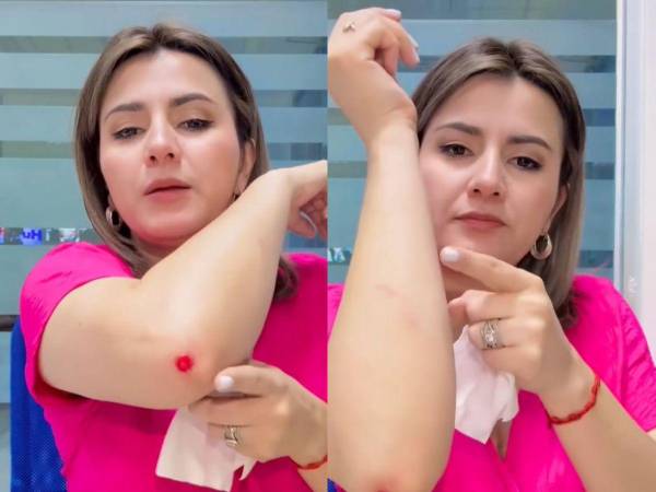 Mediante sus redes sociales, Cesia Mejía explicó a sus seguidores la verdad detrás de sus golpes.