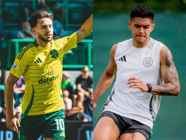 Luis Palma estuvo ausente en el triunfo del Celtic ante el Hibernian por la jornada 2 de la Premier League de Escocia.