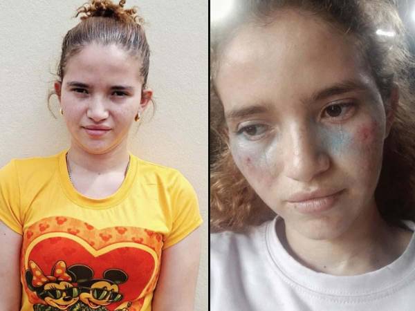 Una hondureña de 23 años fue capturada en la colonia La Unión, en Tegucigalpa, acusada de fingir su propio secuestro en dos ocasiones para obtener dinero de su pareja sentimental y utilizar inteligencia artificial (IA) para fabricar imágenes de lesiones y documentos hospitalarios falsos.