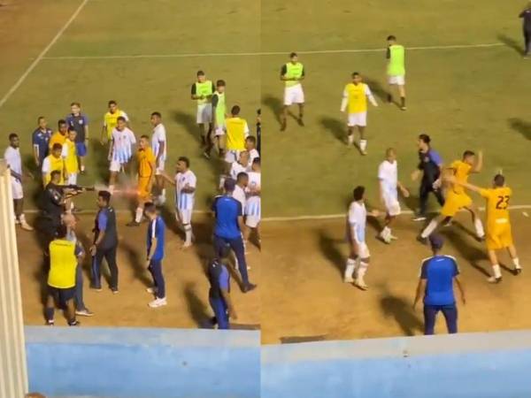 Escándalo: un policía le dispara en la pierna a jugador tras partido en Brasil