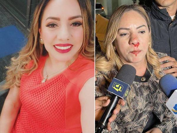 Aún investigan quién agredió a la precandidata.