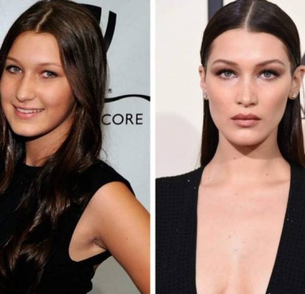 Según The Sun, Bella Hadid tiene un 94.35 por ciento en el índice de 'perfección', pero claro que siendo una famosa que vive de su apariencia no hay duda que la modelo sí recibió ayuda del bisturí, aunque ella lo niegue las fotos de su juventud la delatan.<br/>