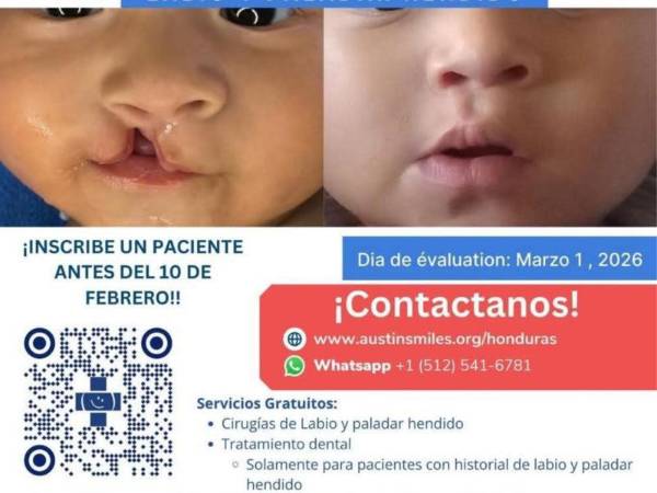 Parte del personal del hospital Leonardo Martínez enfatizó que los interesados deben abocarse a los canales oficiales para obtener información. También pueden acudir directamente al centro asistencial para realizar sus consultas.