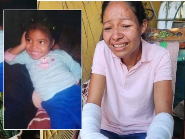 María Montoya, aún con sus manos vendadas y entre el llanto, intenta asimilar que su hija Siloé ya no le pedirá más que la chinee.