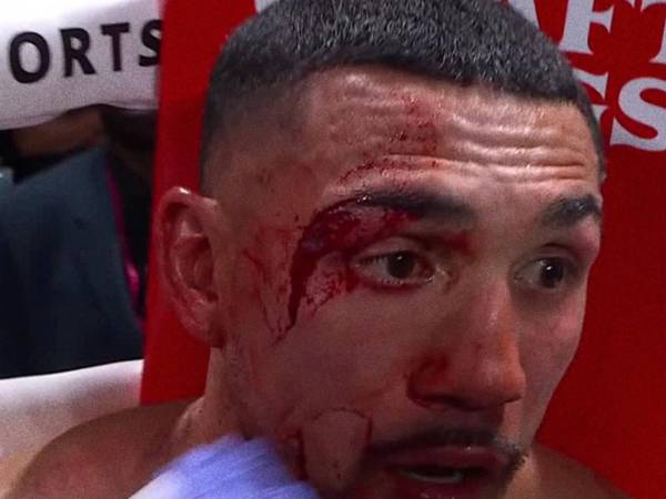 Rostro ensangrentado de Teófimo López.