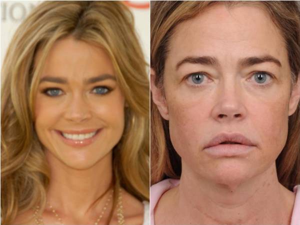 Denise Richards conquistó al mundo con la película Starship Troopers, con sus ojos azules, cejas marcadas y capas desfiladas que definieron los 90. En cierto modo, ella definió la década: de los 90, fue un símbolo sexual, estrella de Wild Things, chica Bond y tuvo cameos en casi todas las series que marcaron la época: Seinfeld, Beverly Hills 90210, Saved by the Bell, Melrose Place y Married... with Children.
