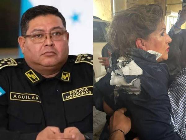 El director de la Policía Nacional de Honduras, Juan Manuel Aguilar Godoy, se pronunció este viernes sobre el ataque ocurrido el jueves 8 de enero contra la diputada del Partido Nacional, Gladis Aurora López, en los bajos del Congreso Nacional.