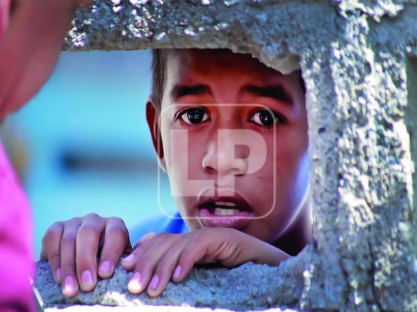 El niño Miguel Umaña se recupera de las lesiones que sufrió en sus dos piernas.