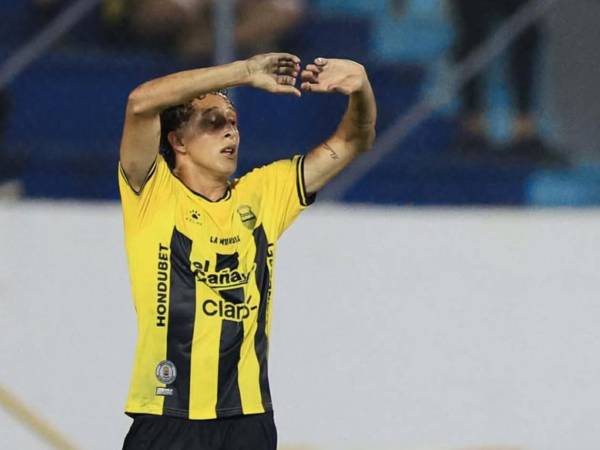 Nixon Cruz marcó un golazo y luego salió expulsado en el duelo donde Real España venció 3-2 al Olimpia.