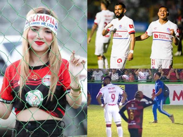 El Olimpia venció por 1-3 al Choloma en el Rubén Deras: te mostramos las mejores imágenes del partido.