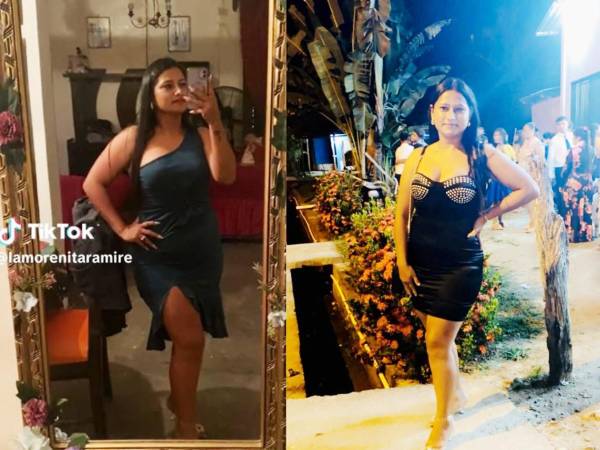 Una joven murió la noche del lunes en un accidente de tránsito ocurrido en Tela, Atlántida, zona atlántica de Honduras. La joven estuvo involucrada en un accidente entre una motocicleta y un camión.