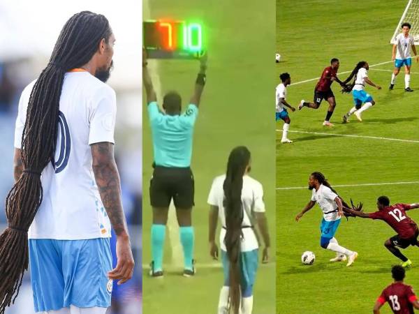 Aedan Scipio, el futbolista con el look más exótico de Concacaf, vuelve a ser noticia debido a su largo cabello que provocó las expulsiones de dos rivales en partido de la Nations League con la penúltima selección del ranking FIFA.