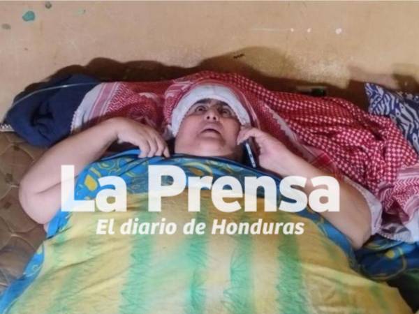 Con obesidad y derrame pulmonar, Basima Hilsaca no se rinde y desde su cama está pendiente de su hermano Nasser aún está internado en el hospital Atlántida.