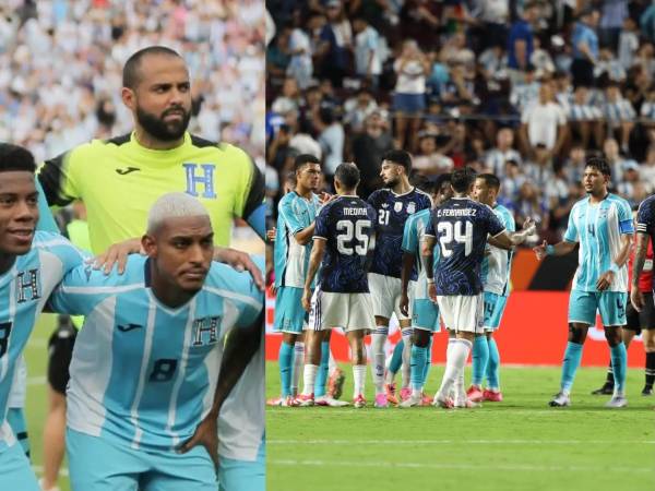 Edrick Menjívar fue el portero titular en el amistoso de Honduras ante Argentina.