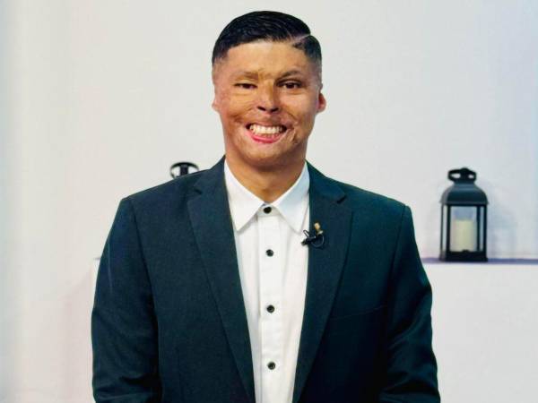 Aunque la elección del próximo alcalde de Tegucigalpa aún está en suspenso, ya hay un nombre que figura con certeza en la posible Corporación Municipal: el de Ever Velásquez, el bombero que sobrevivió a las llamas de La Montañita. Pero... ¿qué lugar ocupará exactamente en la alcaldía si no hay grandes cambios en los resultados?