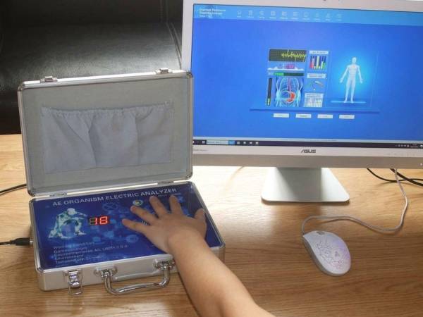 El experto explicó que la tecnología detrás del aparato es mínima: no tiene tanta estructura como tal electrónica como para decir que puede hacer esa cantidad de ensayos, en referencia a los cerca de 45 a 60 diagnósticos distintos que la máquina asegura poder generar con solo colocar las manos en un sensor.